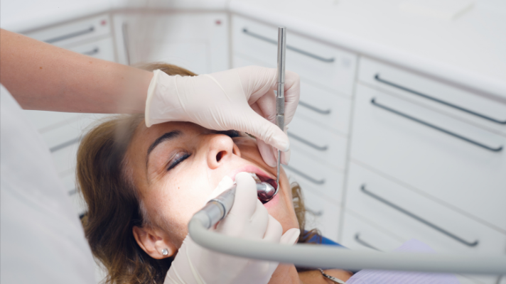 A close-up of a patient's bright, healthy smile during a professional dental polishing procedure.