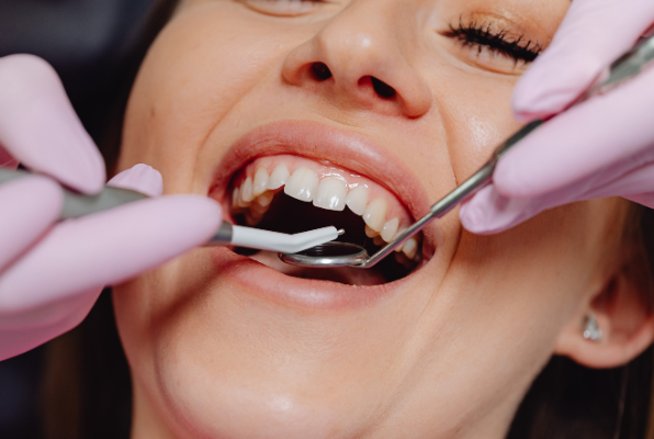A close-up of a smiling patient during a periodic dental exam where a dentist uses a mirror and probe to check for early signs of decay.