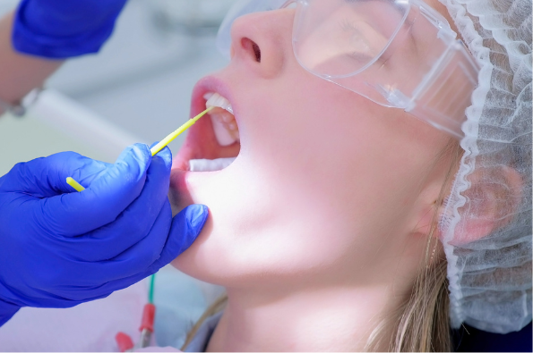 A dental professional in blue gloves applying a yellow fluoride varnish directly to a patient's teeth using a small brush applicator.