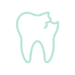 An anatomical tooth model showing deep decay reaching the pulp, illustrating why preventive sealants are necessary.
