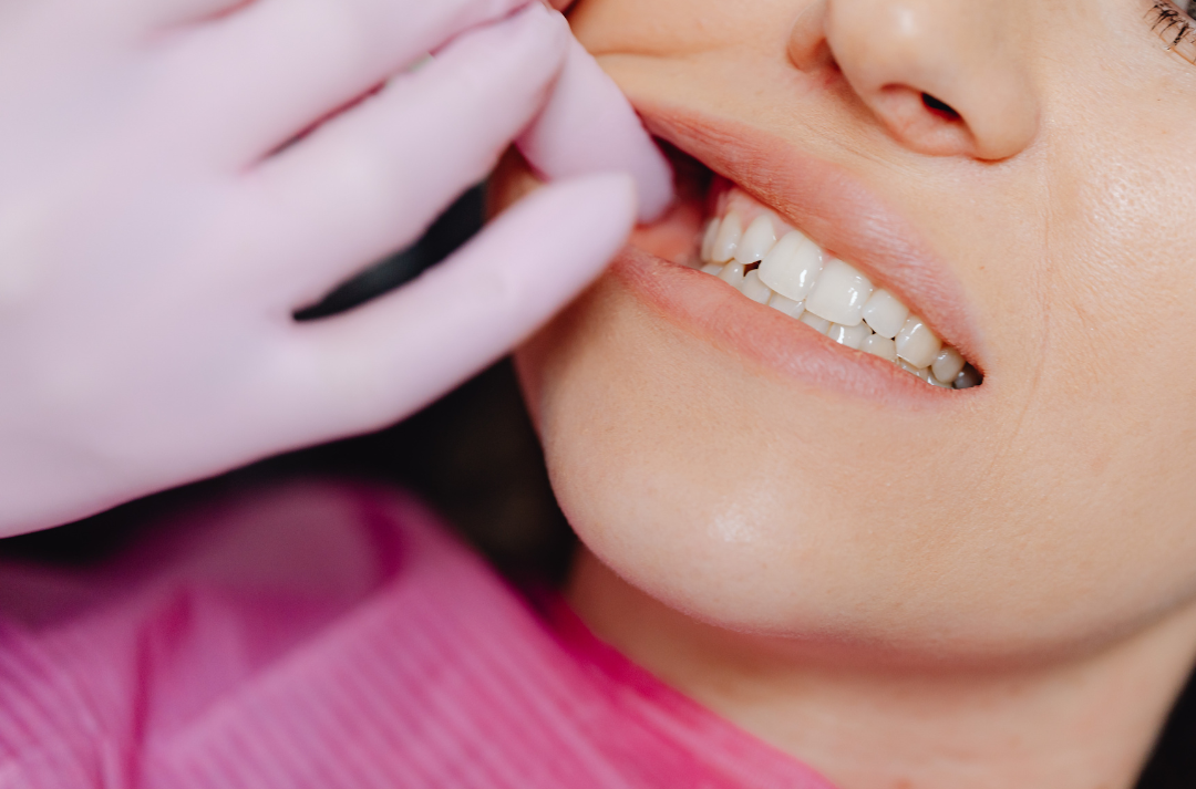 A dental professional in pink gloves performing a clinical inspection of a patient's back teeth to determine the necessity of a surgical extraction.