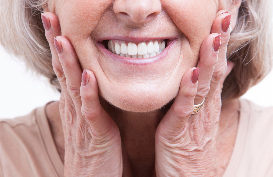 A senior woman smiling broadly, holding her face with both hands, showcasing a natural-looking smile achieved with full dentures.