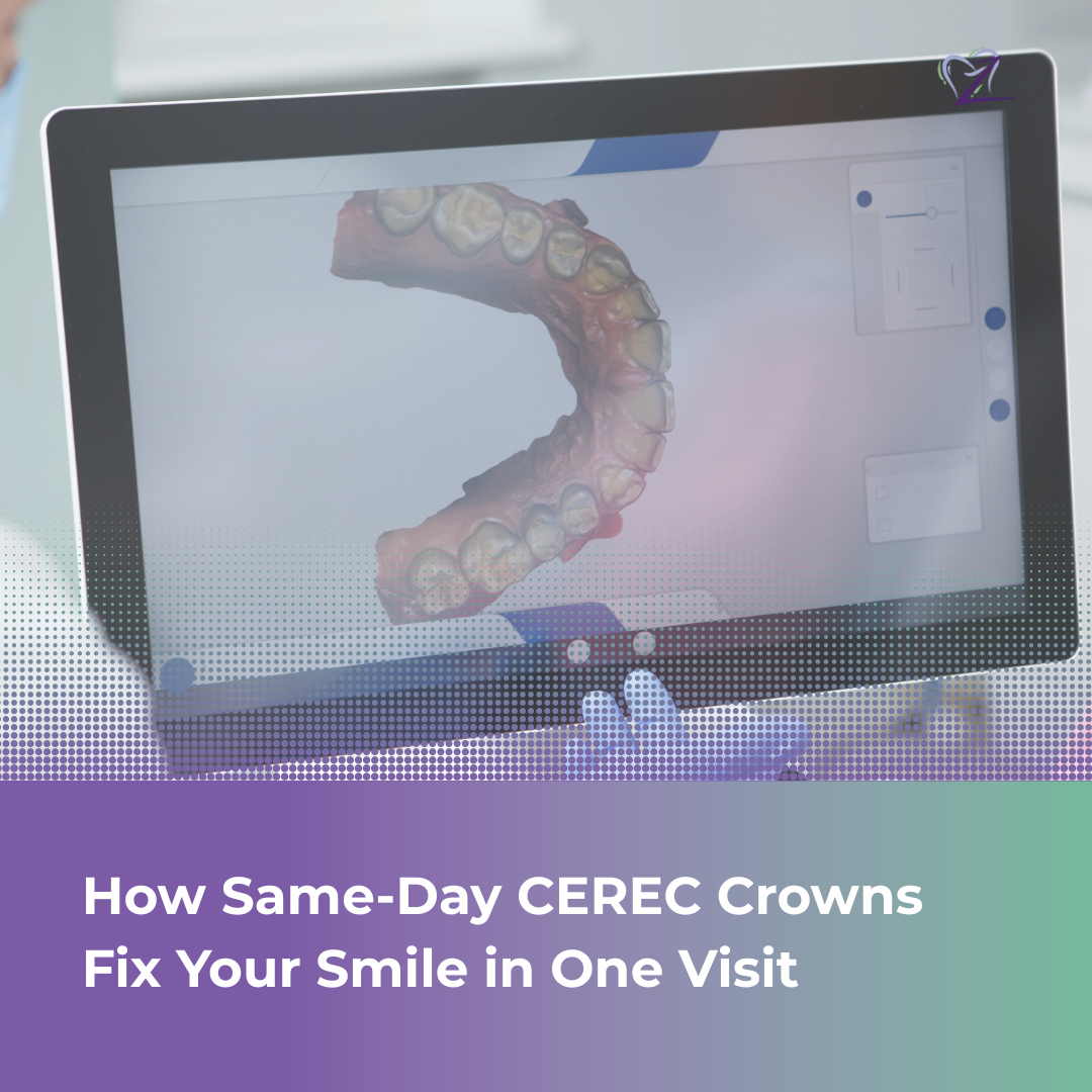 A side-by-side comparison of a patient’s smile before and after receiving a CEREC same-day dental crown.