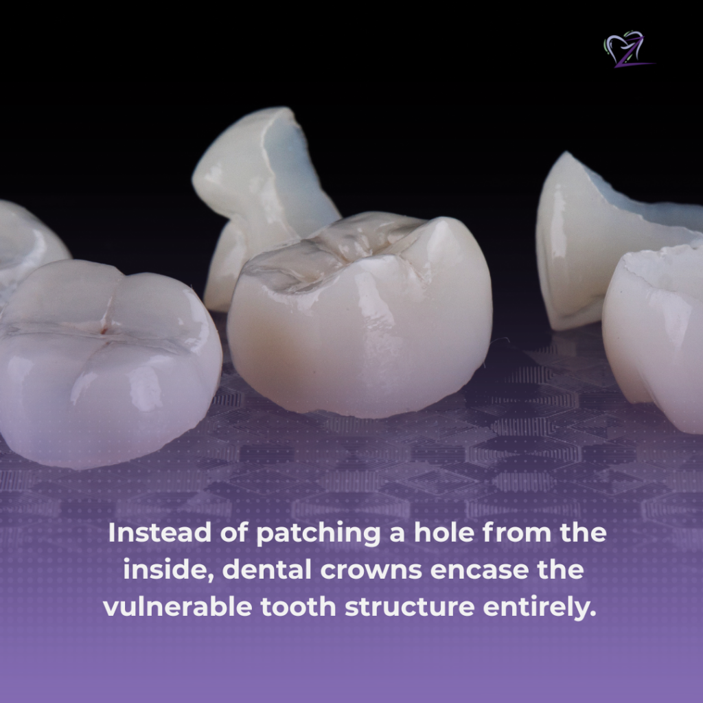 dental crown