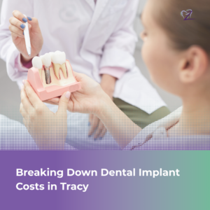 A close-up of a three-part dental implant model on a consultation desk at Smiles Dental Spa in Tracy, CA.