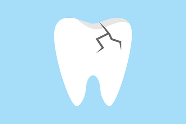 What Happens When A Cracked Tooth Goes Untreated?